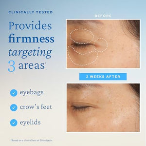 belif Peptide Eye Bomb, Anti-Aging Eye Cream for Wrinkles, Fine Lines, Crow’s Feet & Eye Bags, 48hr Hydration with Ceramide, Squalane, Caffeine, Dermatologist-Tested Korean Skincare, 0.84 fl.oz