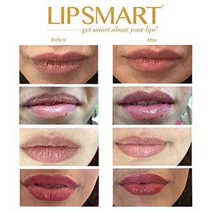 Ultra Hydrating Lip Treatment Moisturizer and Volumizer - Powerful Hydration for Dry Lips (1)