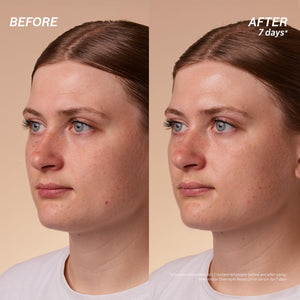 L'Occitane Immortelle Overnight Reset Oil-In-Serum: More Radiant Skin In 1 Night, Smooth Fine Lines, Revitalize Dull Skin, Award-Winner