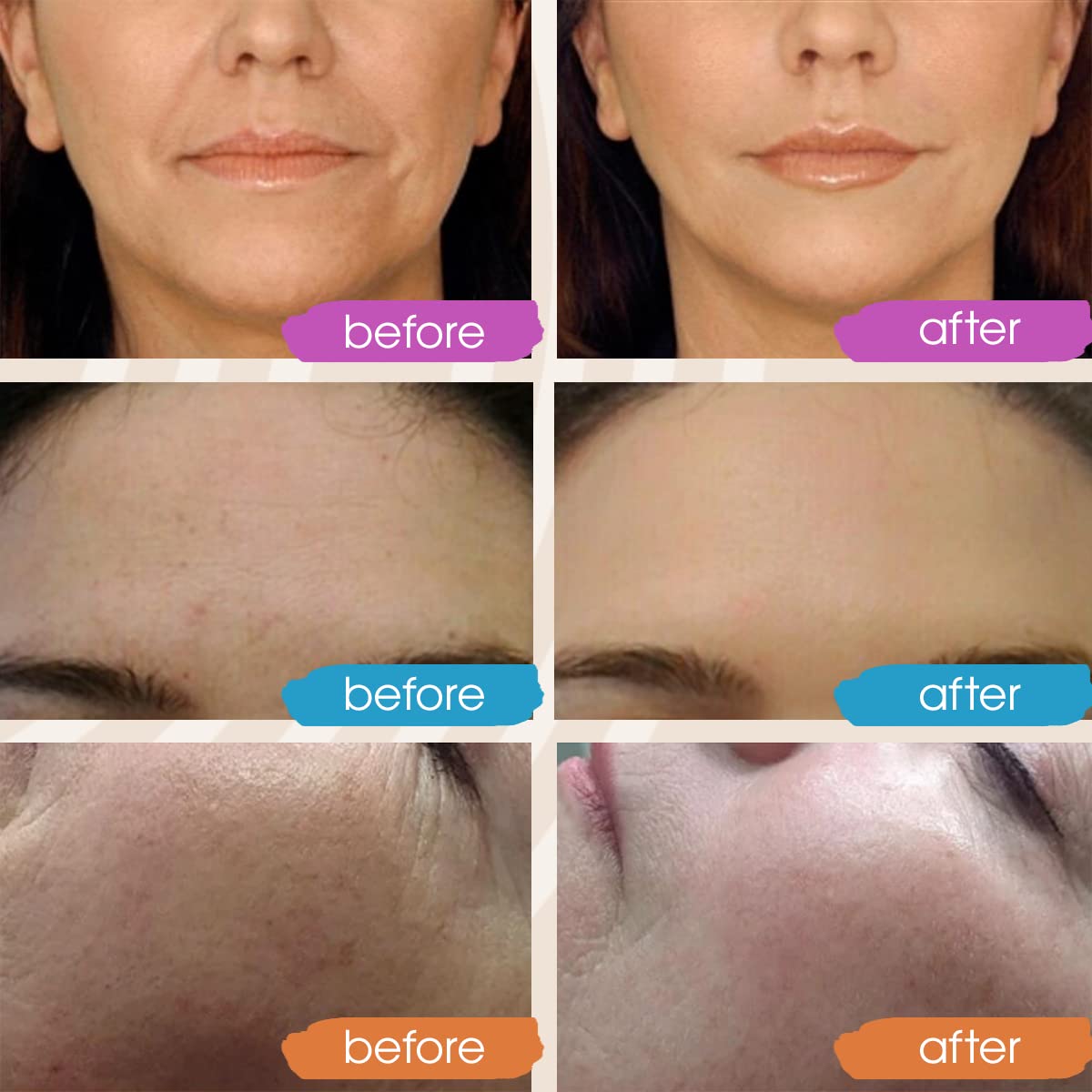Retinol Serum for Face, Vitamin C with Hyaluronic Acid Face Serum for Women and Men, Glow Skin Care Set Targets Appearance of Uneven Skin Tone and Dryness 3x1oz