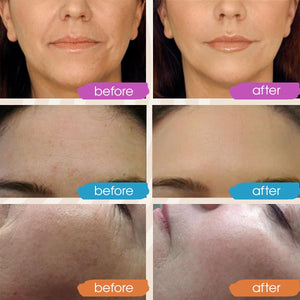 Retinol Serum for Face, Vitamin C with Hyaluronic Acid Face Serum for Women and Men, Glow Skin Care Set Targets Appearance of Uneven Skin Tone and Dryness 3x1oz