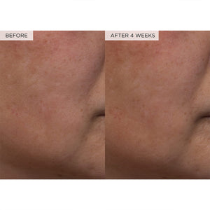 Glow Recipe PHA + BHA Face Toner - Korean Skin Care Pore Minimizer & Gentle Facial Exfoliator for Tightening, Hydrating & Exfoliating - Glycerin, Watermelon & Cactus Water (40ml)