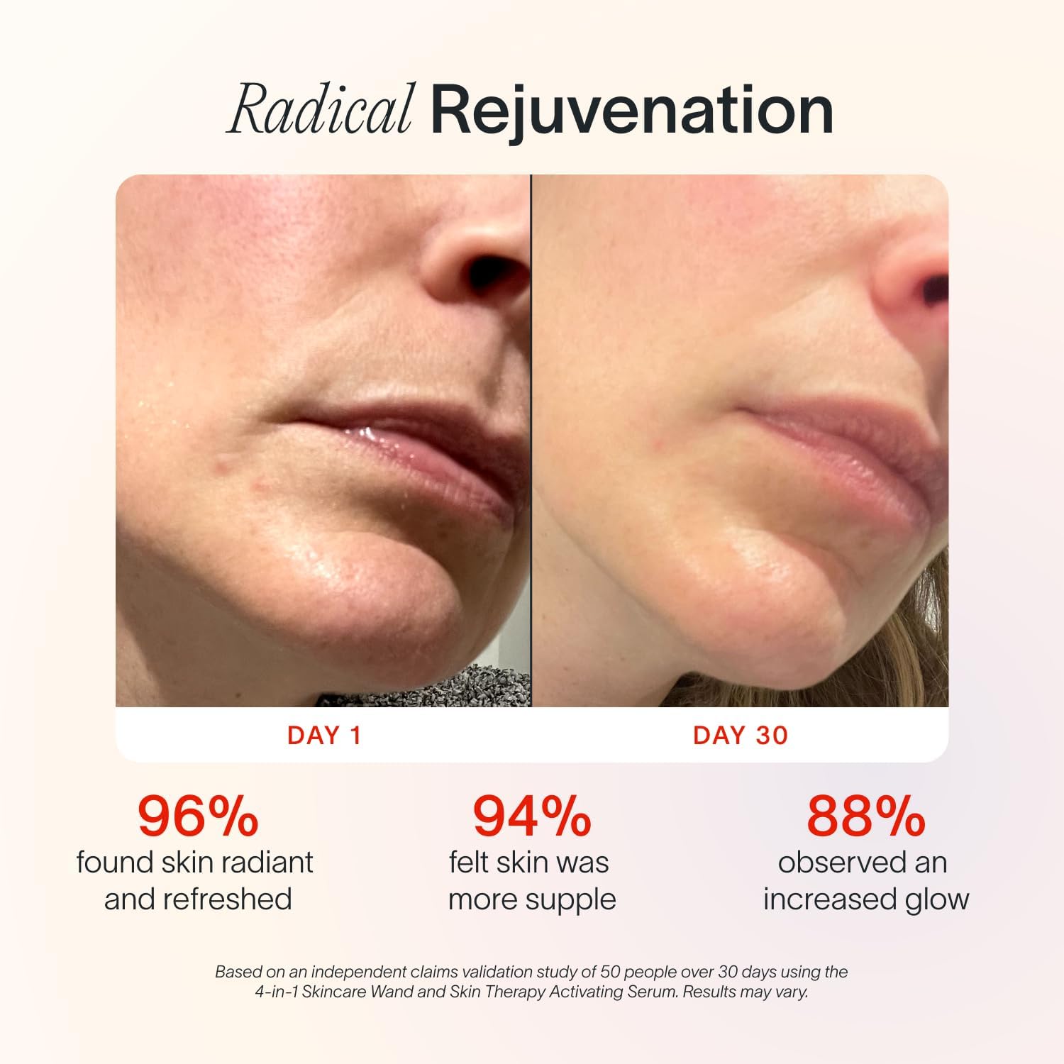SolaWave Skin Therapy Activating Serum with 1 Refill | Enhance Red Light Therapy Wand Results | Hydrating Skincare for Microcurrent Galvanic Current (2-Pack)