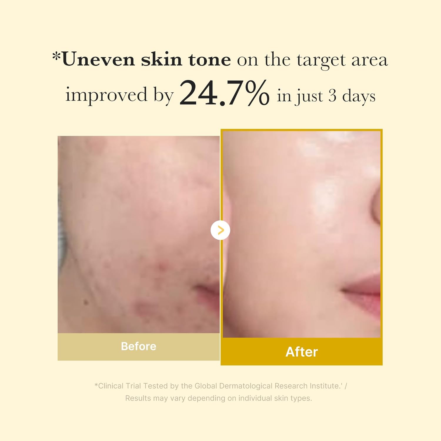 medicube Overnight Wrapping Mask with Collagen, Deep-Cleansing Formula, 100ml