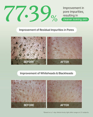 FULLY Green Tomato Clay Mask Cleanser, Pore Purifying with 49% Green Tomato Extract, Sebum & Clogged Pore Care, Exfoliation, Fragrance-Free, Vegan & Dermatologically Tested, 4.05 fl.oz