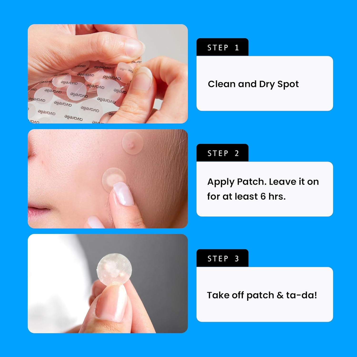 AVARELLE Acne Cover Patches, FSA HSA Eligible Hydrocolloid Pimple Patches for Face with Tea Tree Oil, Korean Skincare Zit Patches for Face | FSA HSA Store Eligible Items | Vegan, Cruelty-free