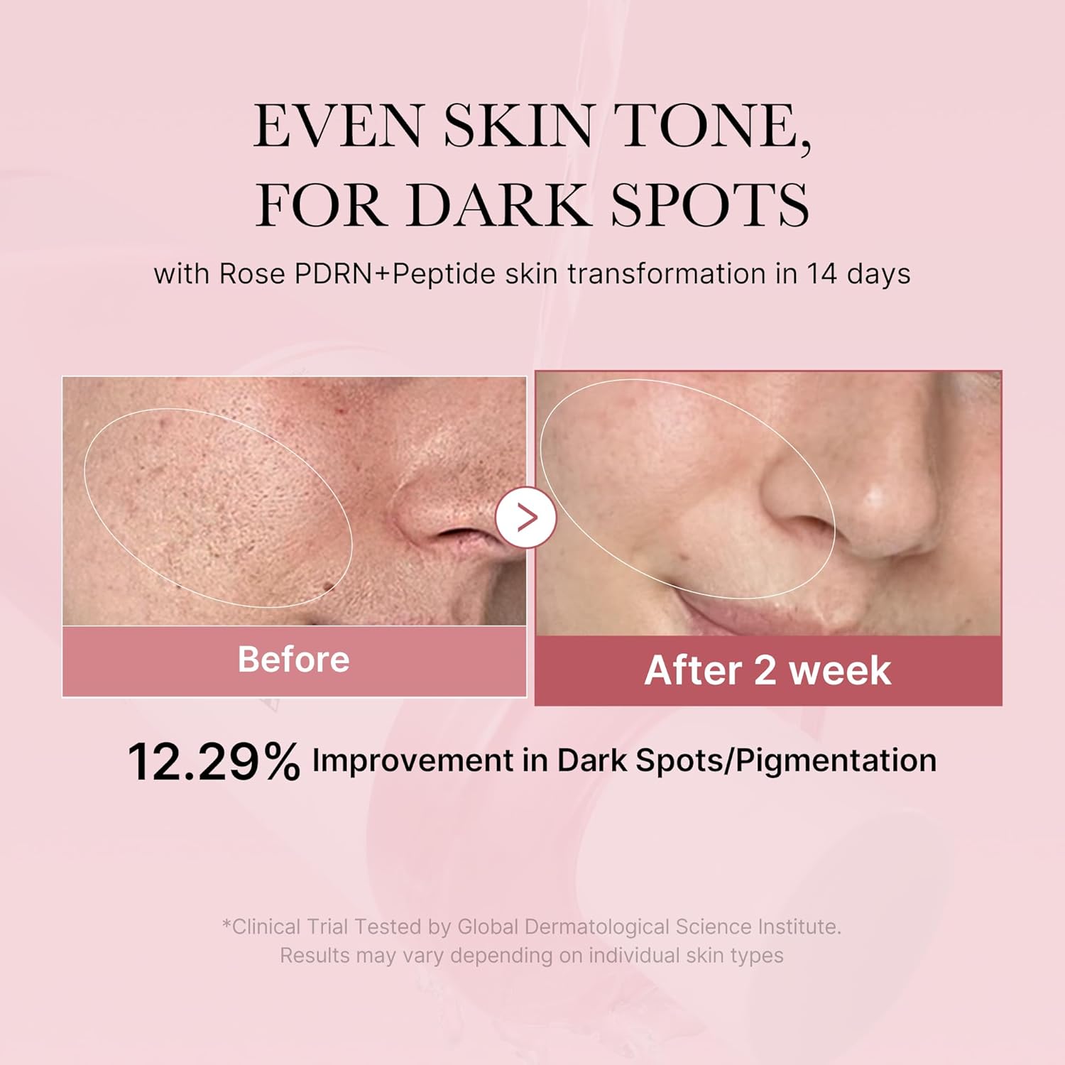 medicube PDRN Pink Peptide Toner I Pink Glow Toner for Skin Boosting, Soothing and Calming, Uneven Skin Tone, Rose PDRN & Peptide & Niacinamide, Korean Skin Care (250ml / 8.45 fl. oz.)
