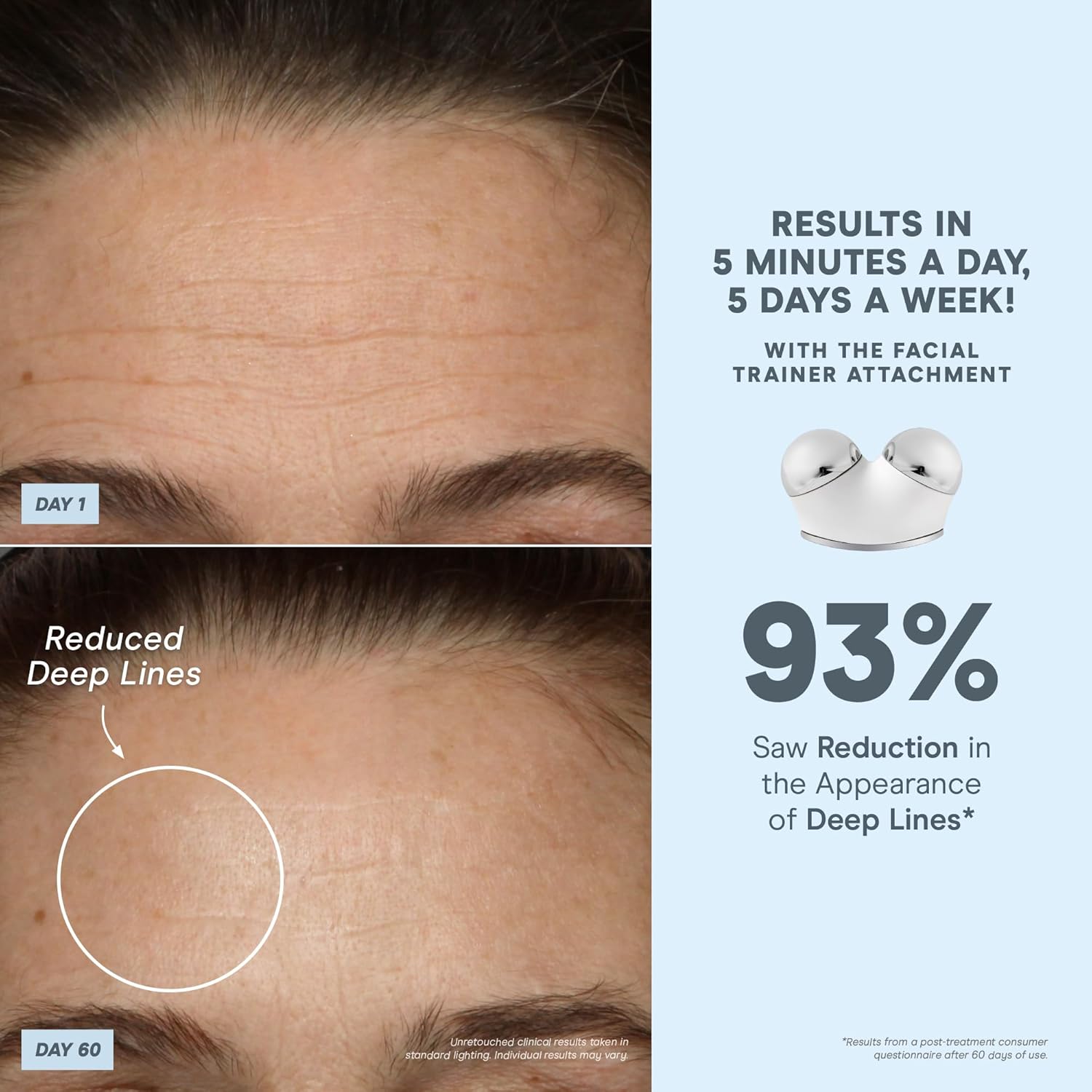 NuFACE TRINITY+ Microcurrent Facial Device + LED Red Light Wrinkle Reducer Attachment - FDA Cleared Skin Tightening Device + Microcurrent Gel Activator & Silk Creme