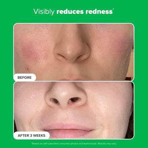Paula's Choice BOOST 10% Azelaic Acid Booster Cream Gel, Licorice Extract & Salicylic Acid, Oil-Free Skin Brightening Serum
