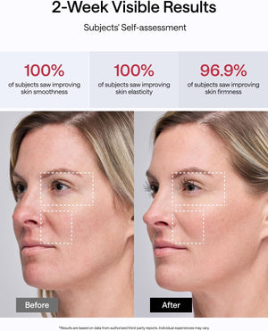 JMOON NouvelleSkin Facial Toning Device, FDA-Cleared Microcurrent Facial Device and Red Light Therapy for Face, 4 Modes & 5 Intensity Levels for Personalized Face Lift & Smoothing. M30U PR