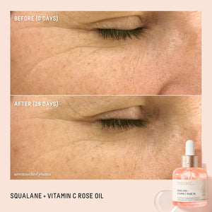 Squalane and Vitamin C Rose Oil