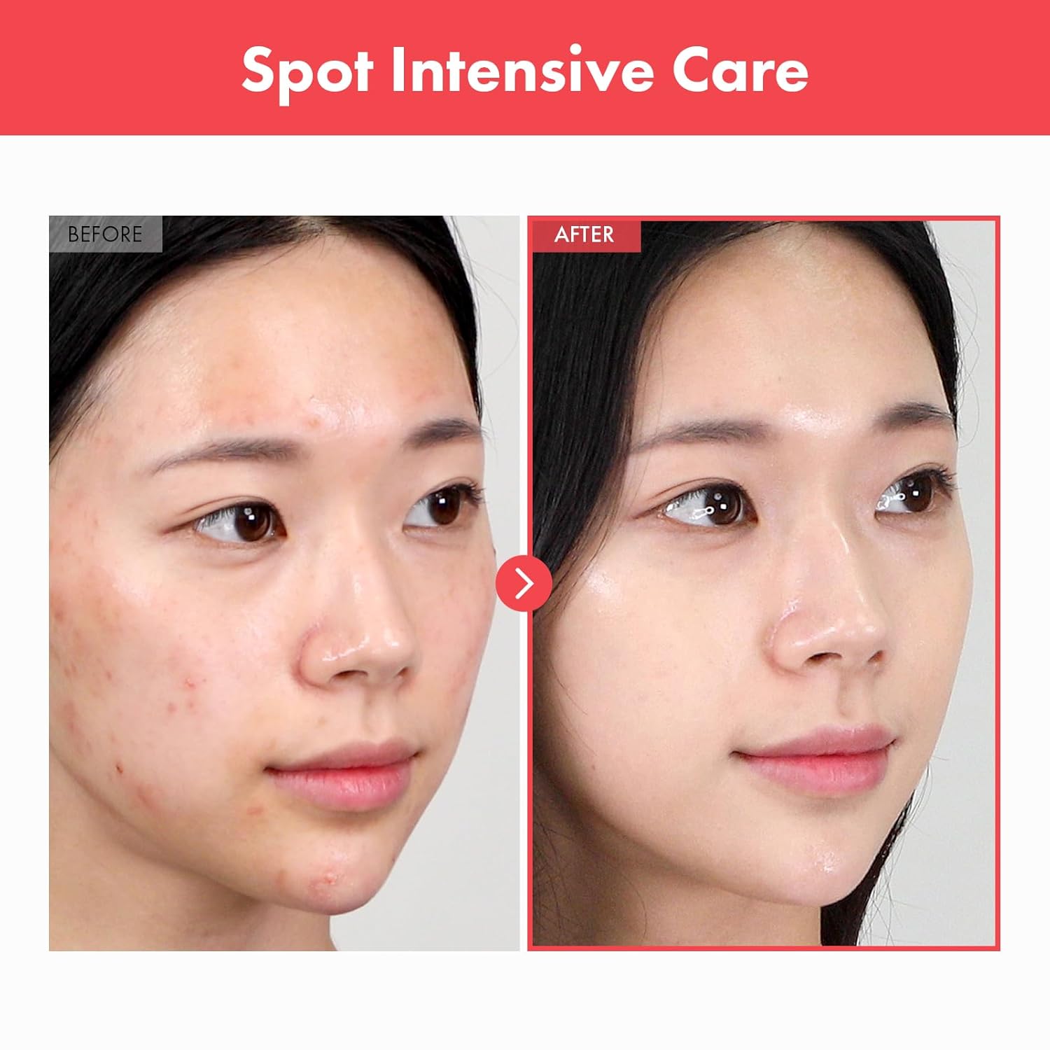 Ovalicin Skin Clear Cream, Skin Soothing, Moisturizing with Niacinamide and Sulfur, Korean Skincare, 50g, 1.76 oz.