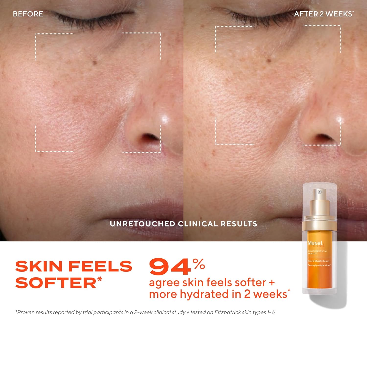Murad Vita-C Glycolic Serum - Advanced Brightening Vitamin C and Glycolic Acid Face Serum for Improved Skin Tone and Texture - Gold-Stabilized Vitamin C for Enhanced Efficacy and Potency