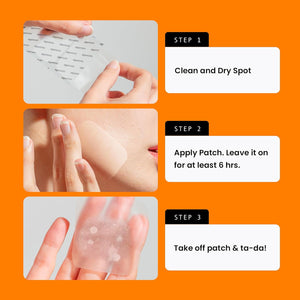 AVARELLE Acne Patches XL, FSA HSA Acne Cover Patch Large | Pimple Patches for Face Cheek & Nose (8 Count) | Large Hydrocolloid Acne Treatment with Tea Tree, Calendula, & Cica