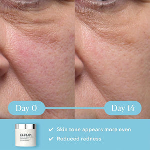 ELEMIS Dynamic Resurfacing Facial Pads with Lactic Acid, Dual Textured Treatment Facial Exfoliating Pads