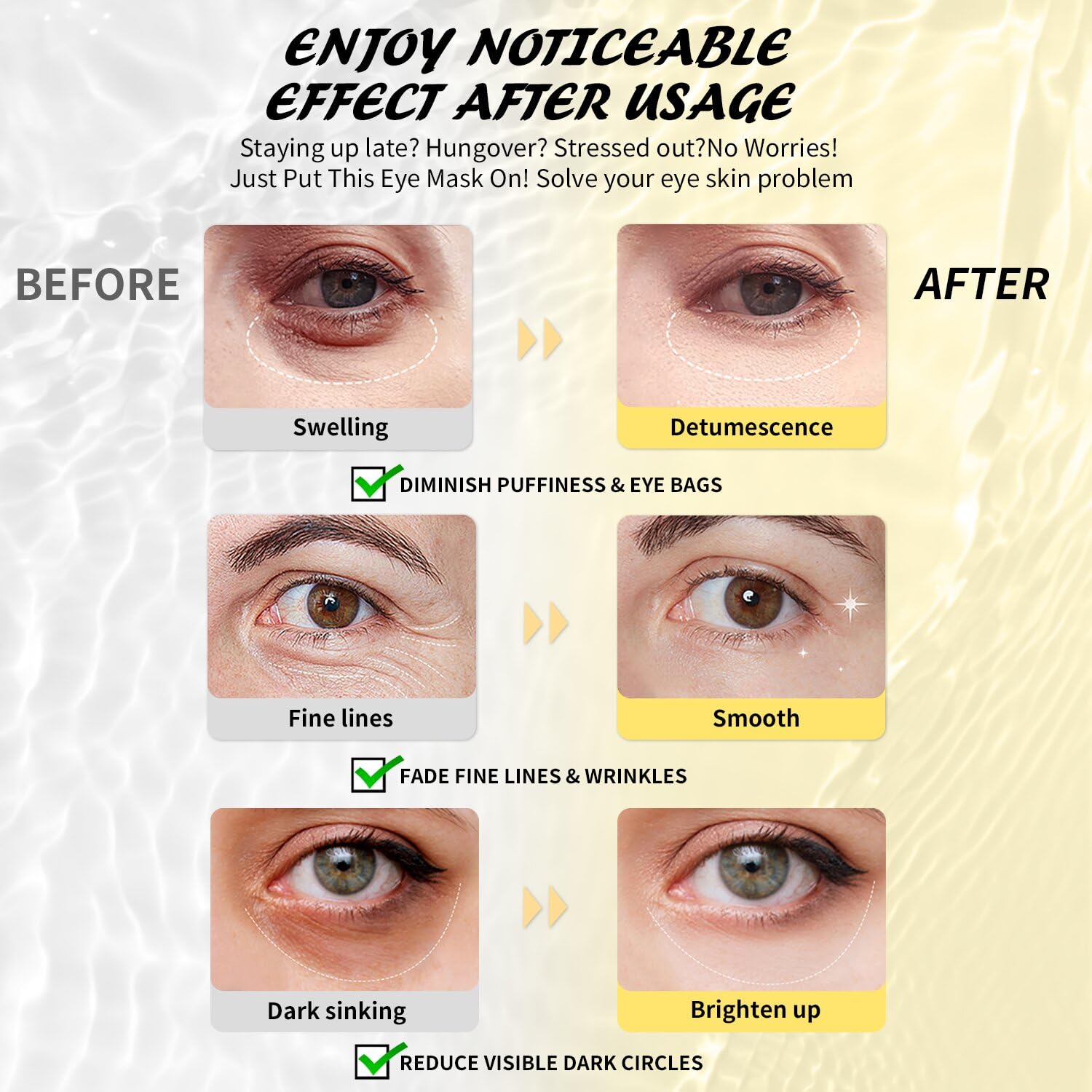 Under Eye Patches(50 Pairs), 24K Gold, Caffeine, Hyaluronic Acid, Aloe Vera Eye Masks for Dark Circles Puffy Eyes Undereye Bags, Eye Skin Care Gift Set for Bachelorette Party Favors