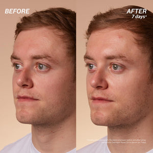 L'Occitane Immortelle Overnight Reset Oil-In-Serum: More Radiant Skin In 1 Night, Smooth Fine Lines, Revitalize Dull Skin, Award-Winner