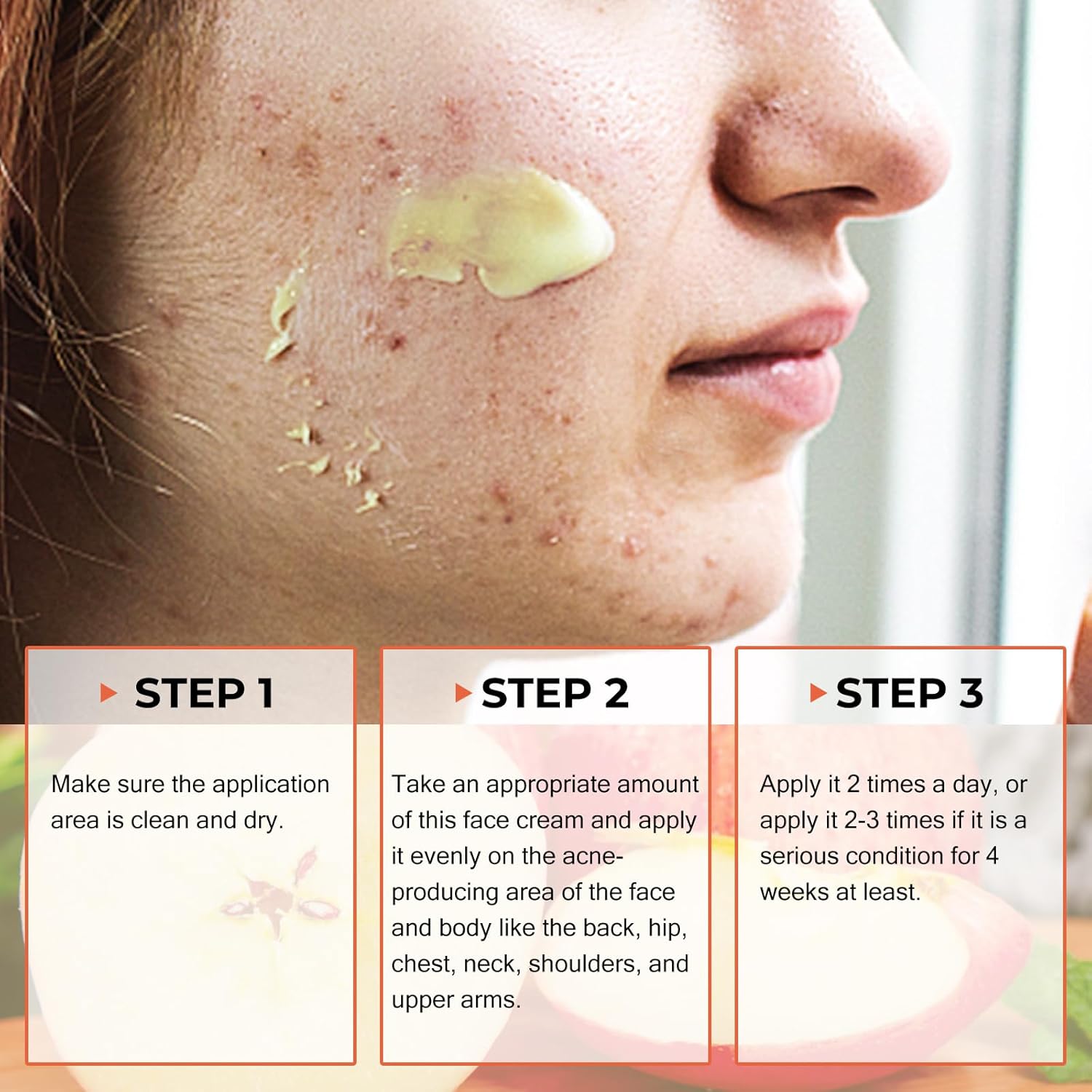 Acne Cream, Salicylic Acid Cystic Acne Treatment For Face, Back Butt Acne Treatments Creams, Acne Spot Treatment for Face Body, Acne Clearing Pimple Cream for Teens & Adults, Acne Moisturizer