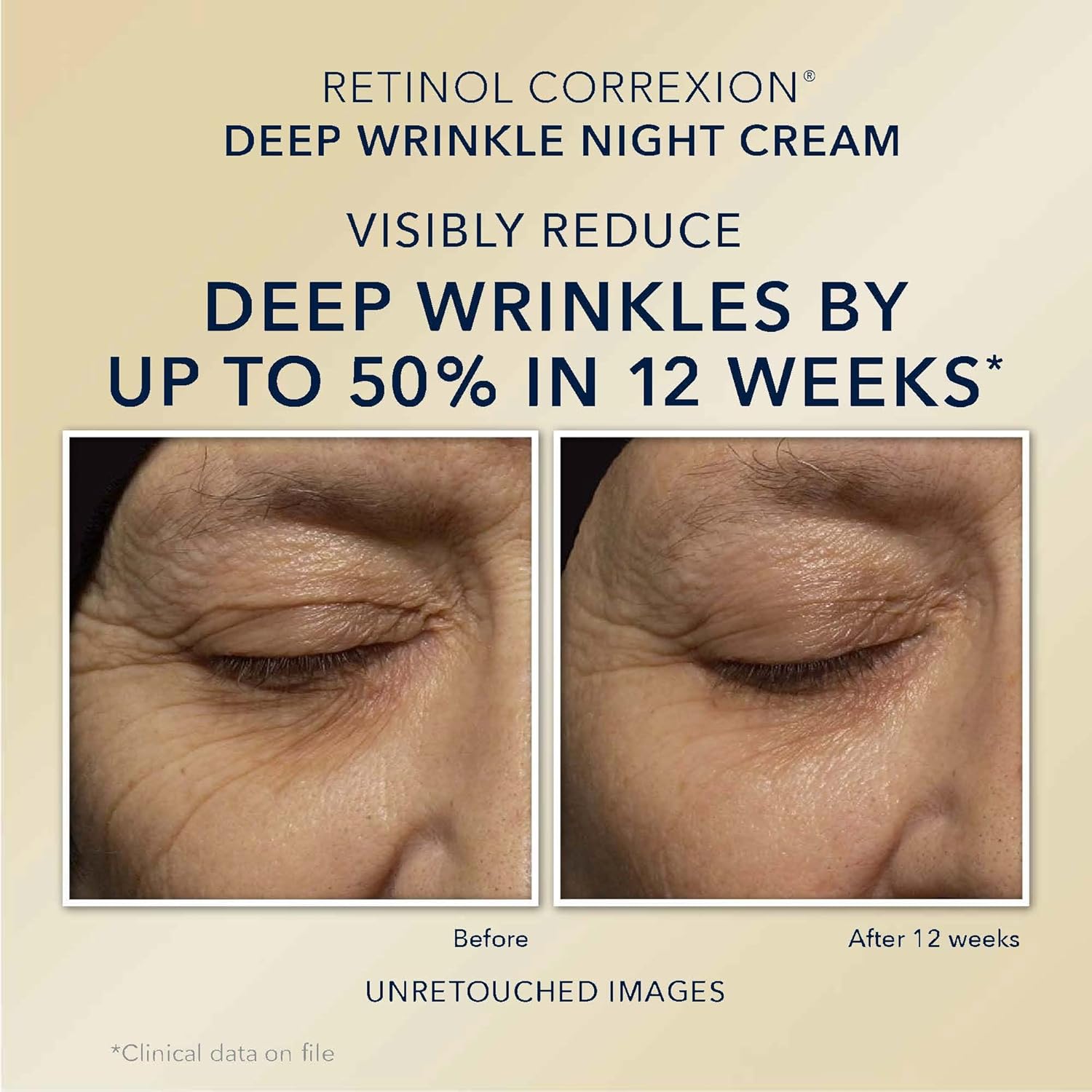 RoC Retinol Correxion Value Set Duo, Deep Wrinkle Anti-Aging Night Face Cream + Daily Under Eye Cream for Dark Circles & Puffiness , Skin Care Set (Packaging May Vary)