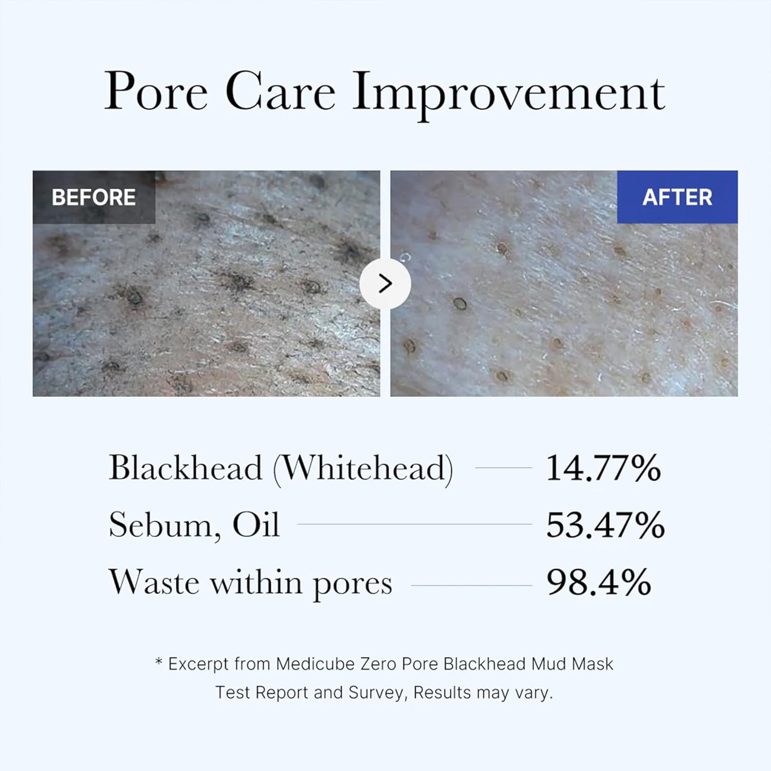 medicube Zero Pore Blackhead Mud Facial Mask - Skin Cooling & Pore Tightening - 3 Minute Quick Dry Formula with AHA, BHA, PHA, and Pore-Purifying Clay - Korean Mud Mask 3.52 oz