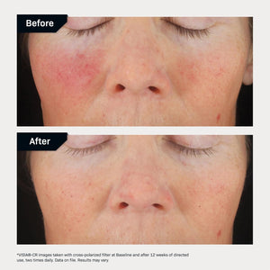 Revision Skincare C+ Correcting Complex 30%® Face Serum – Anti-Aging Antioxidant Blend with Vitamin C, Reduces Fine Lines & Wrinkles, Brightens & Firms Skin, Safe for Sensitive Skin