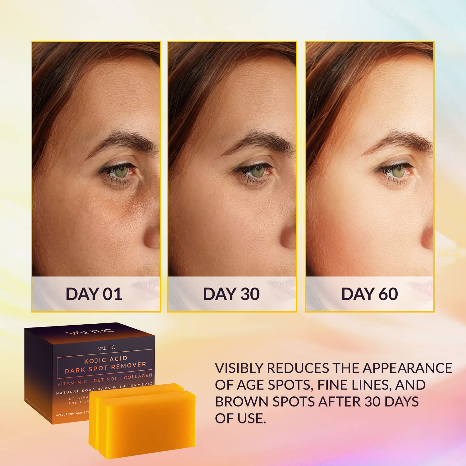 VALITIC Dark Spot Remover Soap Bars with Vitamin C, Retinol, Collagen, Turmeric - Original Japanese Complex Infused with Hyaluronic Acid, Vitamin E, Shea Butter, Castile Olive Oil (2 Pack)
