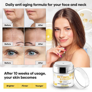 Retinol Night Cream for Face and Neck – Hydrating Moisturizer with Collagen & Hyaluronic Acid