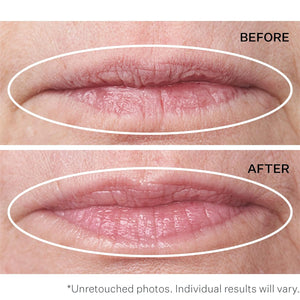 StriVectin Anti-Wrinkle Double Fix for Lips Plump and Smooth Vertical Lines, Hydrating Two-in-One Treatment, 0.16 Fl O