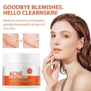 Acne Cream, Salicylic Acid Cystic Acne Treatment For Face, Back Butt Acne Treatments Creams, Acne Spot Treatment for Face Body, Acne Clearing Pimple Cream for Teens & Adults, Acne Moisturizer