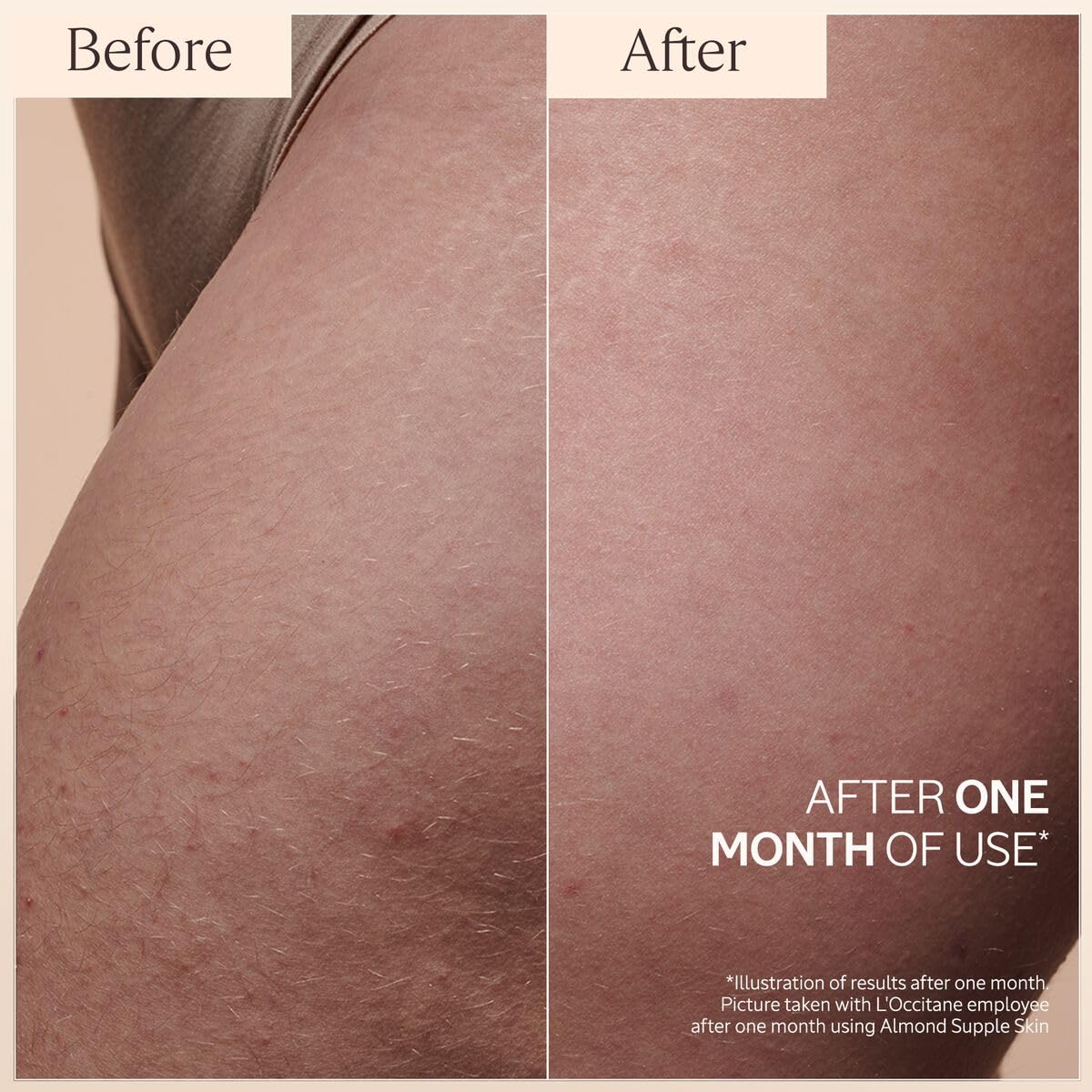 L'Occitane Almond Body Oil, Moisturizes, Nourishes, Hydrates, Softens Dry Skin, Absorbs Fast, Lightweight, Non-Greasy, Luxurious Post-Shower Skincare