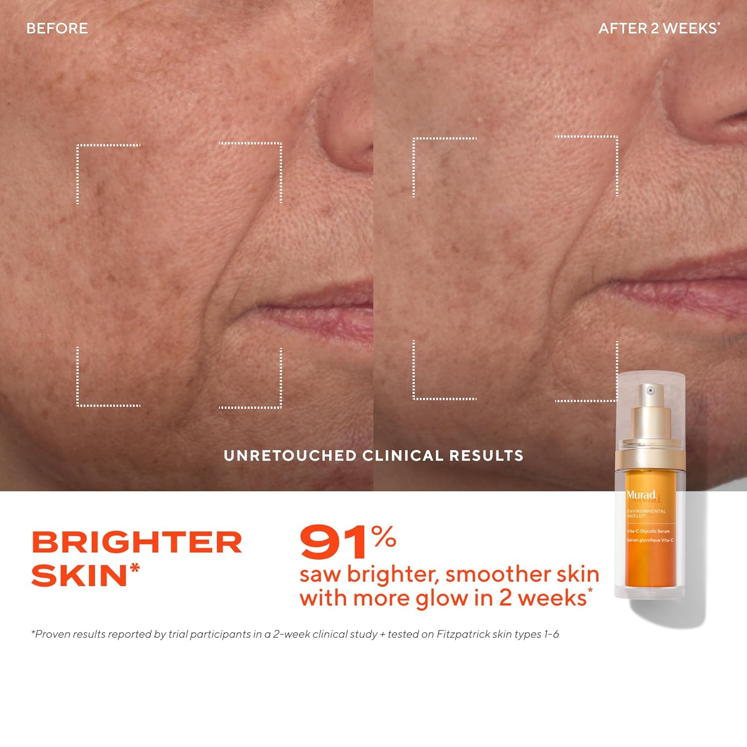 Murad Vita-C Glycolic Serum - Advanced Brightening Vitamin C and Glycolic Acid Face Serum for Improved Skin Tone and Texture - Gold-Stabilized Vitamin C for Enhanced Efficacy and Potency