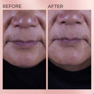 Elizabeth Arden Retinol + HPR Ceramide Rapid Skin Renewing Water Cream Face Moisturizer, Anti-Aging Wrinkle Treatment, Niacinamide, Hyaluronic Acid, Ceramides & Peptides, 1.7 fl oz