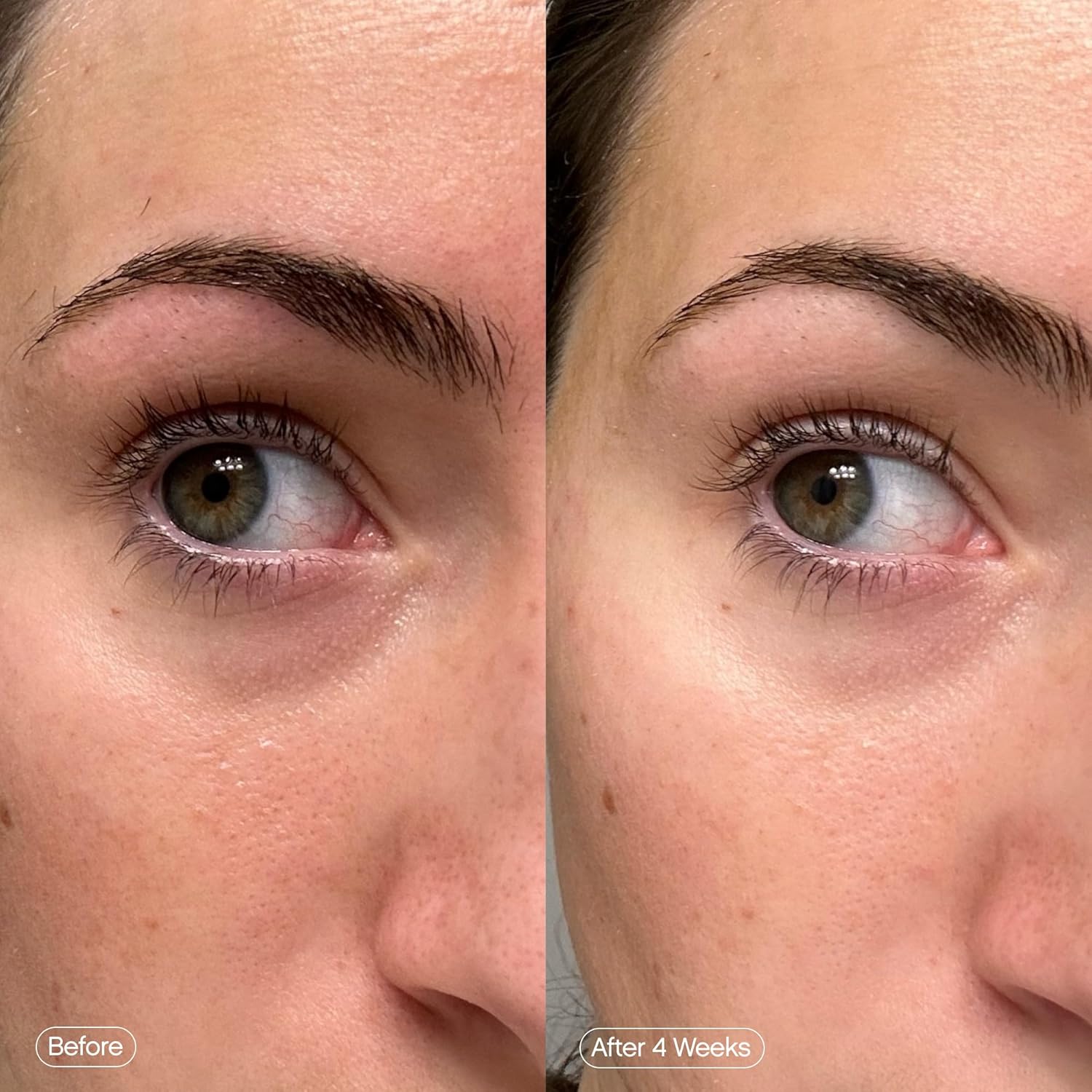 Topicals Faded Brightening Under Eye Masks | Revitalizing Patches to Depuff, Hydrate, and Illuminate | Diminishes Dark Circles and Fine Lines | Made with Kojic Acid, Caffeine & Niacinamide