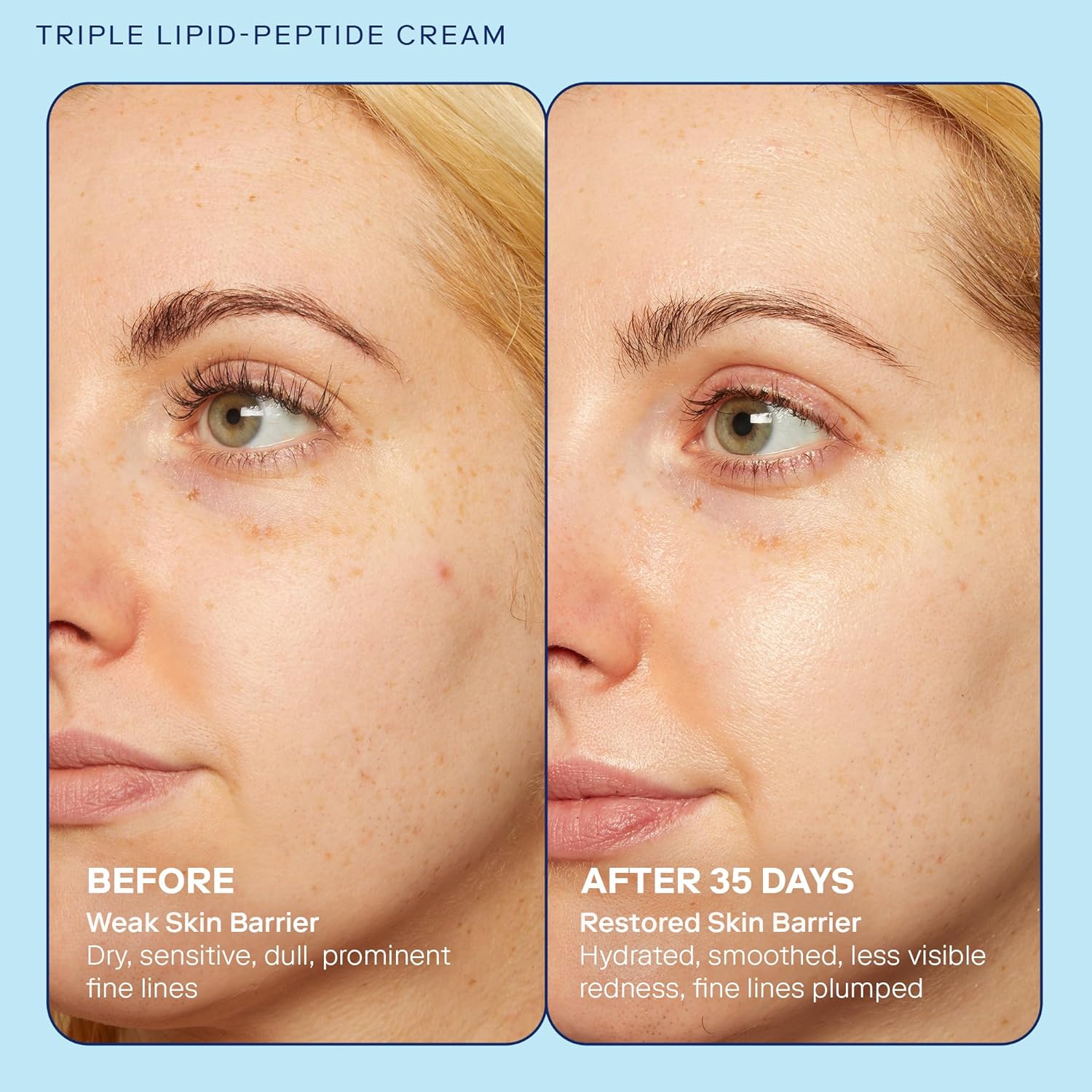 Skinfix Barrier+ Triple Lipid-Peptide Cream: Enriched with Lipids, Peptides, Hyaluronic Acid, and Shea Butter for Brightening, Firming, and Plumping, 1.7 oz