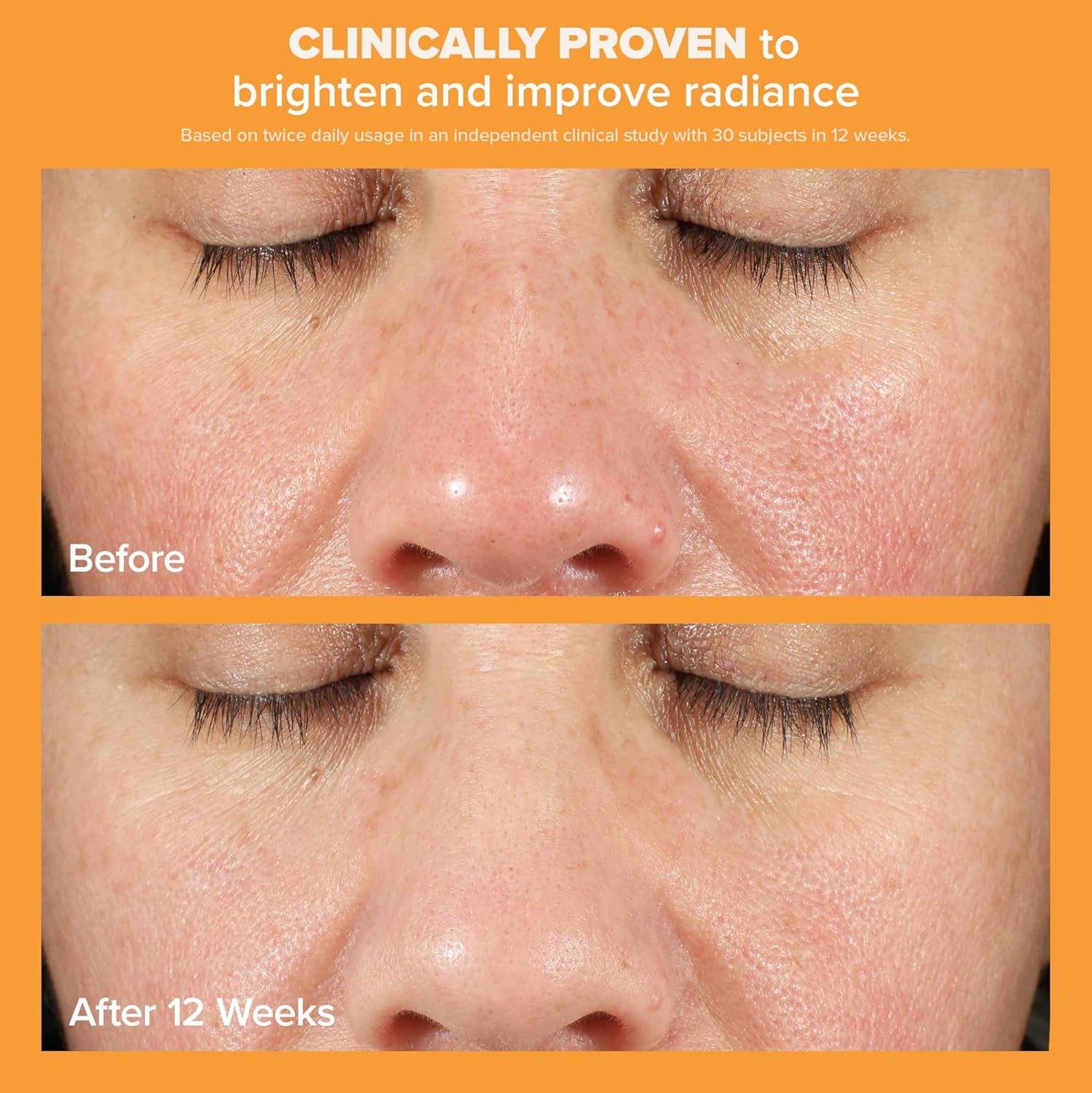 Paula's Choice BOOST C15 Super Booster, 15% Vitamin C with Vitamin E & Ferulic Acid, Skin Brightening Serum, 0.67 Ounces