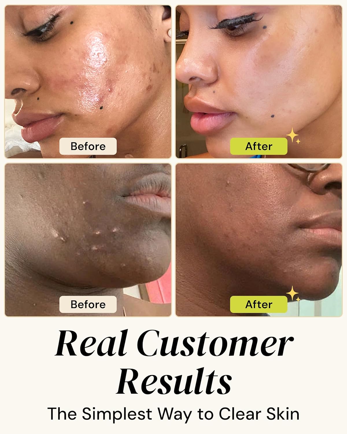 Gleamin Vitamin C Clay Mask for Dark Spots,10-Minutes Turmeric Clay Face Mask Skin Care, Deep Cleansing Pores - Facial Improves Uneven Tone, Post-Blemish, Visibly Brighten, Scarring & Texture - 2.5 Oz