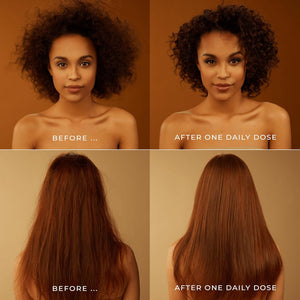 DAILY DOSE Leave-In Conditioner Spray - Detangles, Moisturizes & Eliminates Frizz, Lightweight Formula, Safe for All Hair Types, Paraben-Free, Vegan, Cruelty-Free, Award-Winning - 8.5 oz