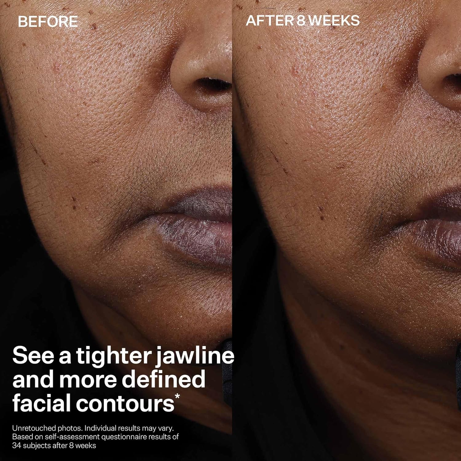StriVectin Peptight Face Lift Serum – Peptides for Smoother, Radiant Skin, 30 mL