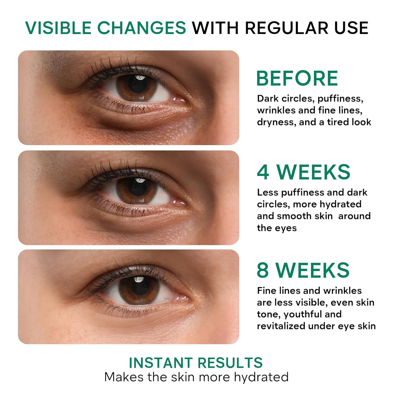 REMEDIAL PAX Eye Cream for Dark Circles and Puffiness, Bags Under Eyes Treatment, Anti-Aging Collagen Eye Cream for Wrinkles, Day & Night Caffeine Eye Cream with Niacinamide Dimethicone