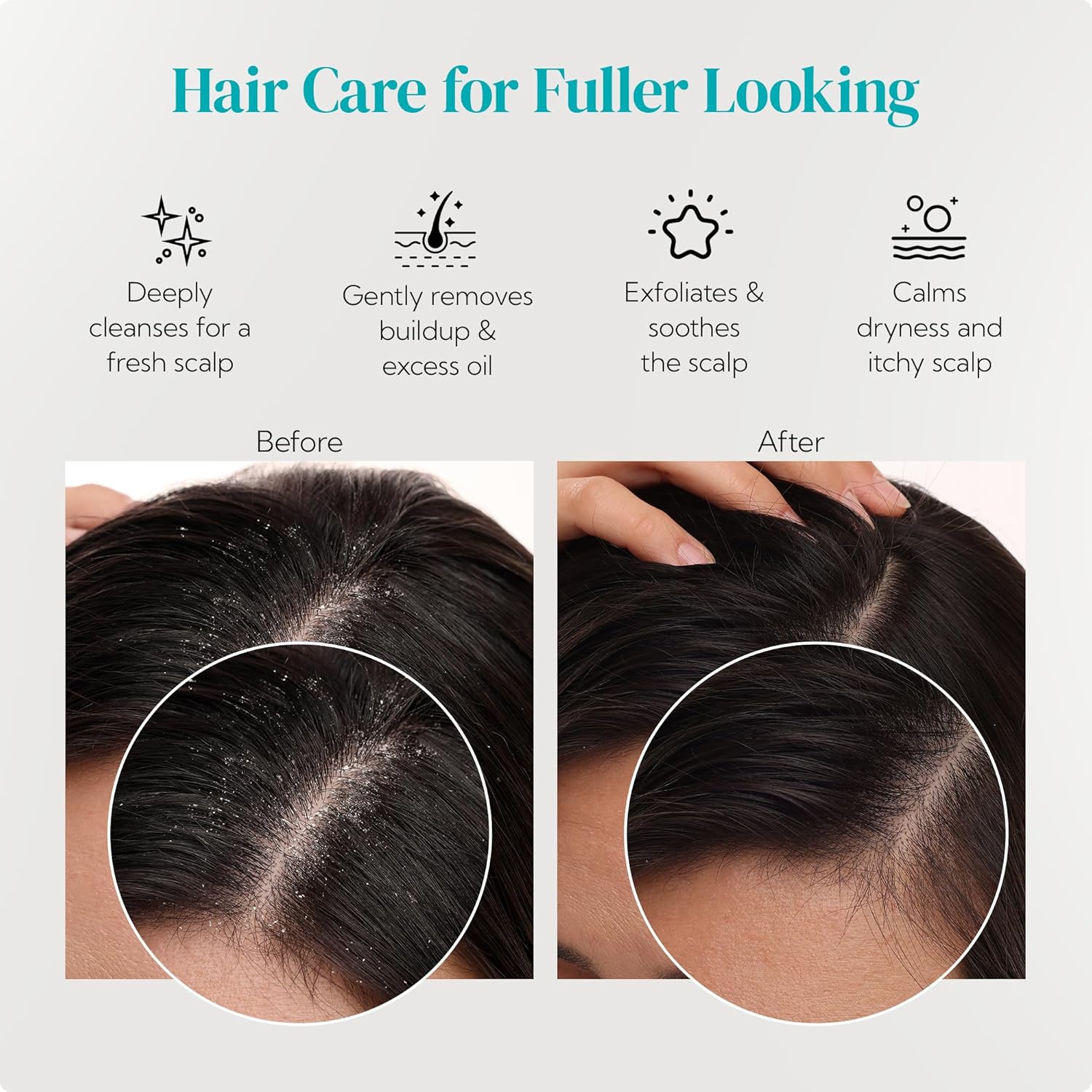 HEETA Hair Scalp Massager Shampoo Brush 2 Pack, Soft Silicone Bristles to Remove Dandruff, Waterproof Hair Scrubber for Both Wet Dry Hair, Suitable for Men & Women (Green & Black)