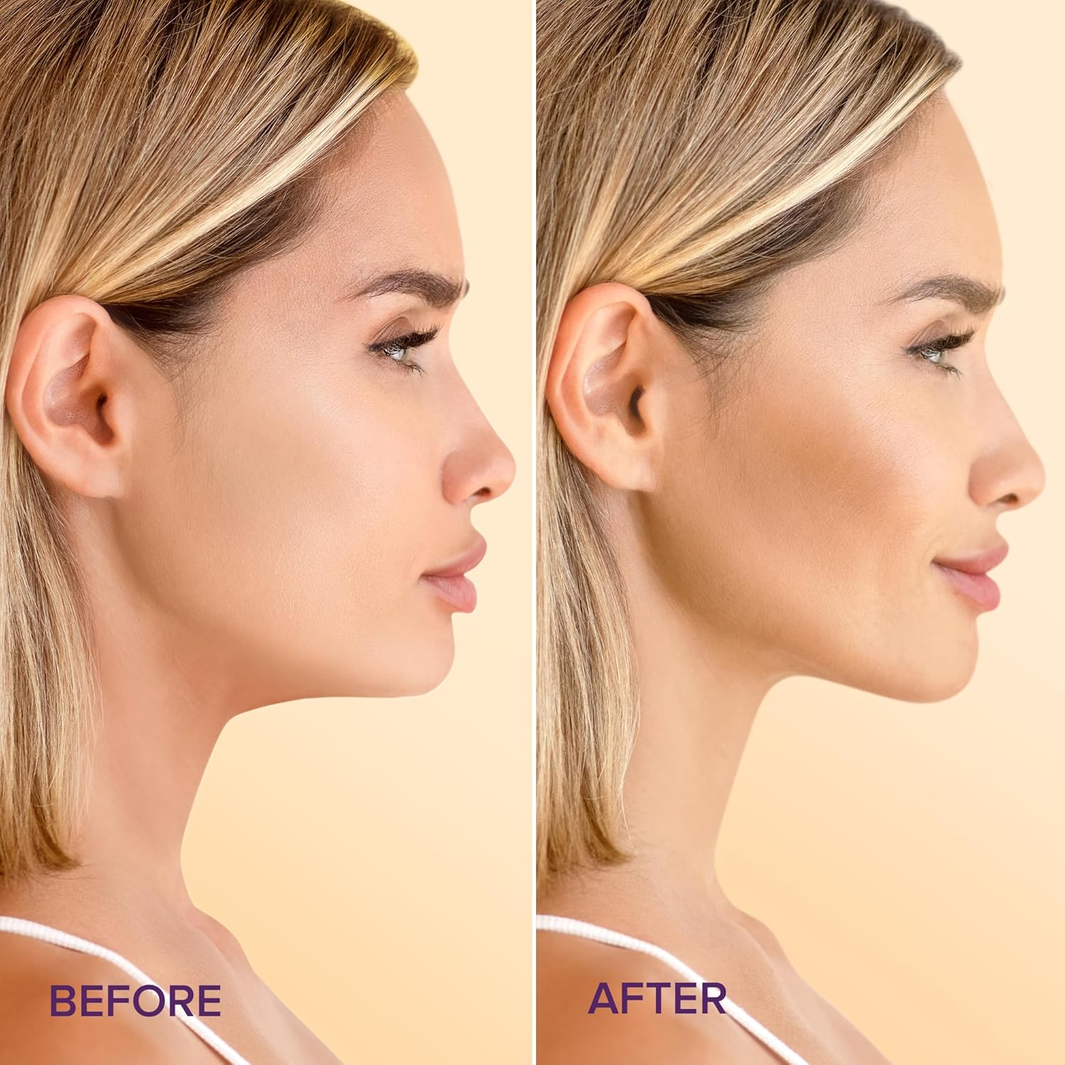 MAREE V Line Lifting Mask with 24K Gold - Deep Collagen Jawline Shaper Mask with Retinol for Face Lift - Facial Skincare Chin Strap - Hyaluronic Acid, Vitamin E - 5 PACK