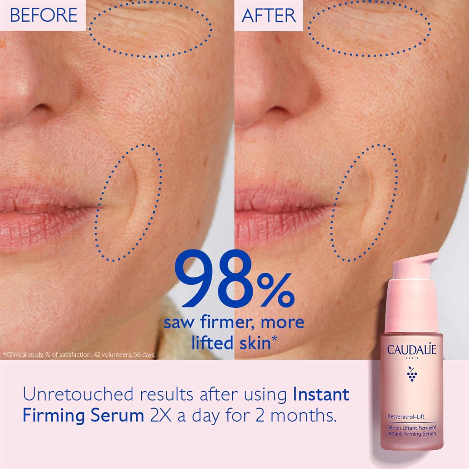 Caudalie Resveratrol-Lift Instant Firming Retinol Alternative Serum, Refillable - 30 mL