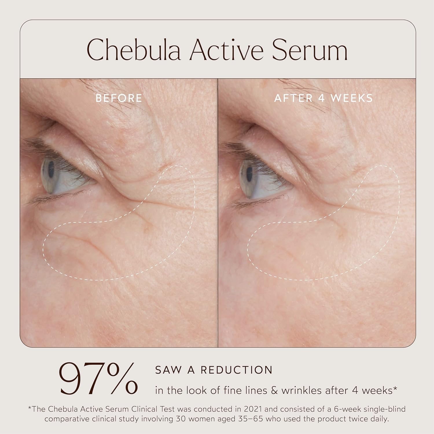 True Botanicals Chebula Active Serum | Optimizes Skins Collagen Levels | Anti-Aging Serum | Treats Fine Lines & Wrinkles | All Skin Types | Dermatologist Tested, All Natural, Vegan | 1 fl oz | 30 ml
