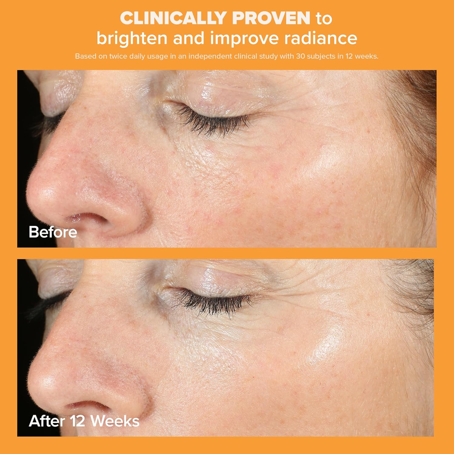 Paula's Choice BOOST C15 Super Booster, 15% Vitamin C with Vitamin E & Ferulic Acid, Skin Brightening Serum, 0.67 Ounces