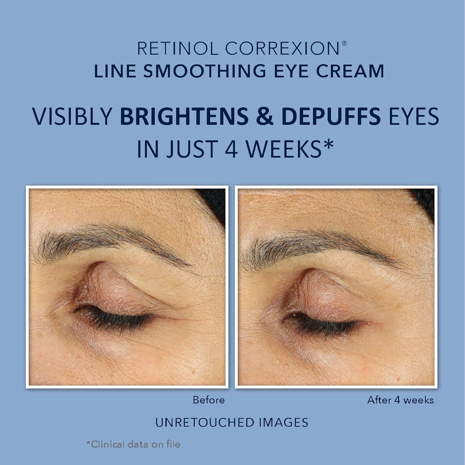 RoC Retinol Correxion Value Set Duo, Deep Wrinkle Anti-Aging Night Face Cream + Daily Under Eye Cream for Dark Circles & Puffiness , Skin Care Set (Packaging May Vary)
