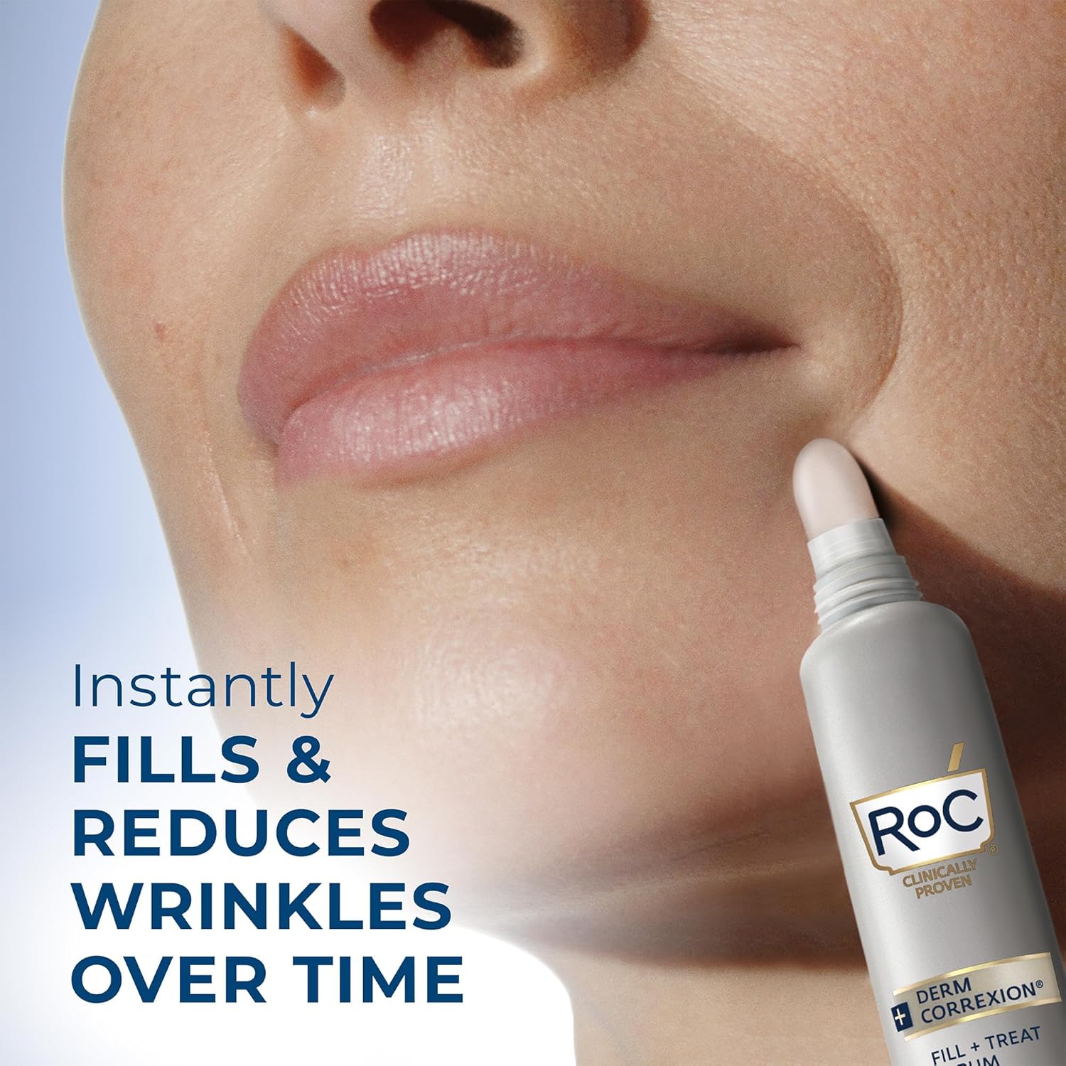 RoC Derm Correxion Fill + Treat Advanced Retinol Serum, Wrinkle Filler Treatment with Hyaluronic Acid for Crow's Feet, 11 Wrinkles, & Laugh Lines, (.5 fl oz) with Retinol Packette (Packaging May Vary)