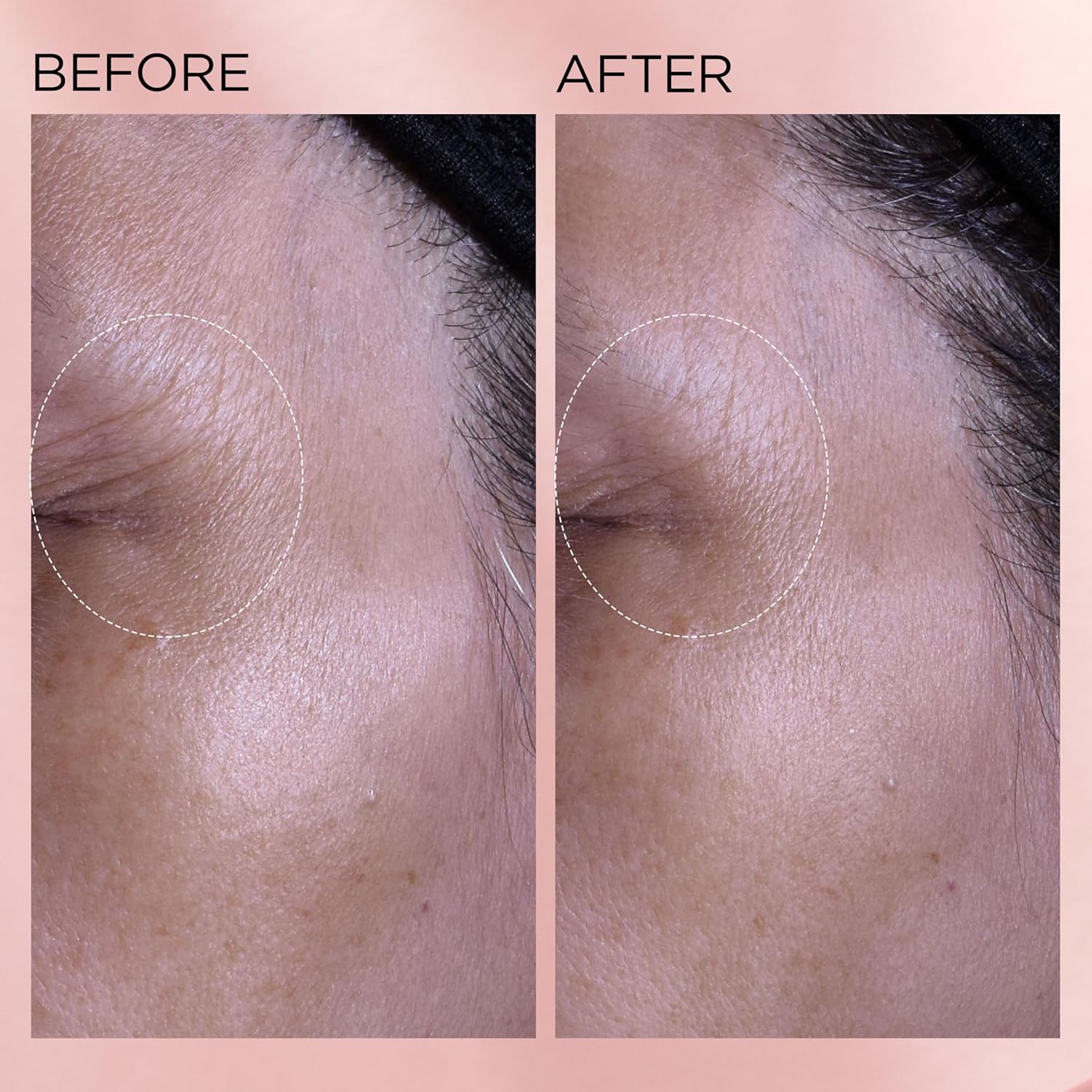 Elizabeth Arden Retinol + HPR Ceramide Rapid Skin Renewing Water Cream Face Moisturizer, Anti-Aging Wrinkle Treatment, Niacinamide, Hyaluronic Acid, Ceramides & Peptides, 1.7 fl oz