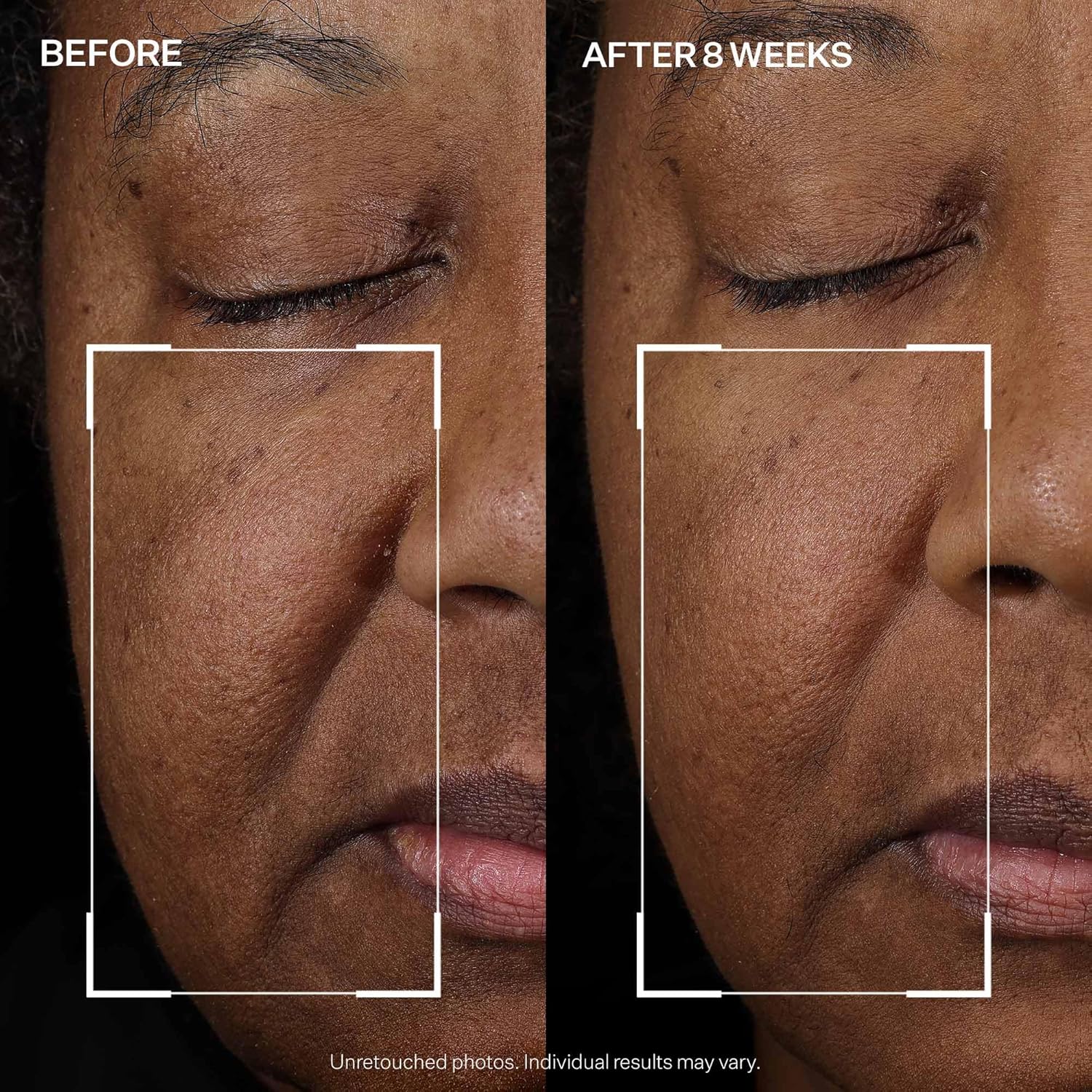 StriVectin Peptight Face Lift Serum – Peptides for Smoother, Radiant Skin, 30 mL